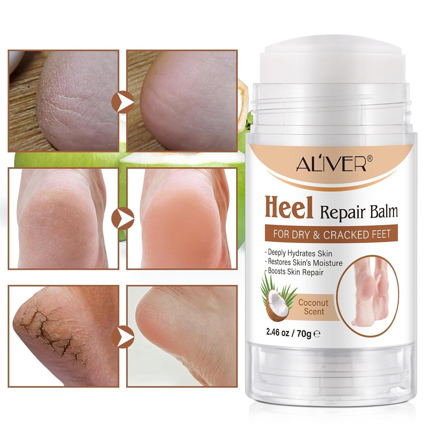 2PCS Heel Repair Balm, Dry & Cracked Feet Treatment Moisturizer, Coconut Scent, 2.46 oz/70 g
