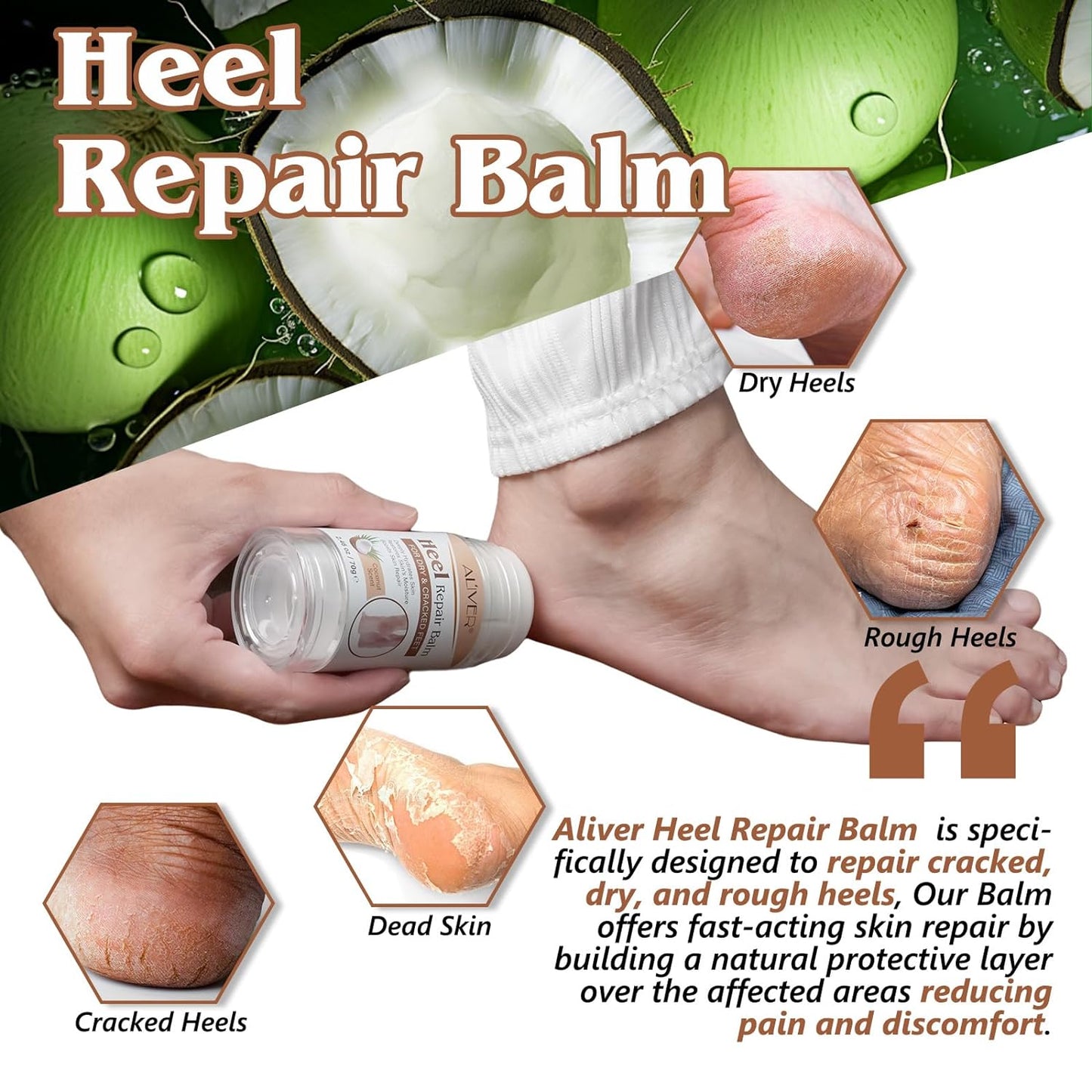 2PCS Heel Repair Balm, Dry & Cracked Feet Treatment Moisturizer, Coconut Scent, 2.46 oz/70 g